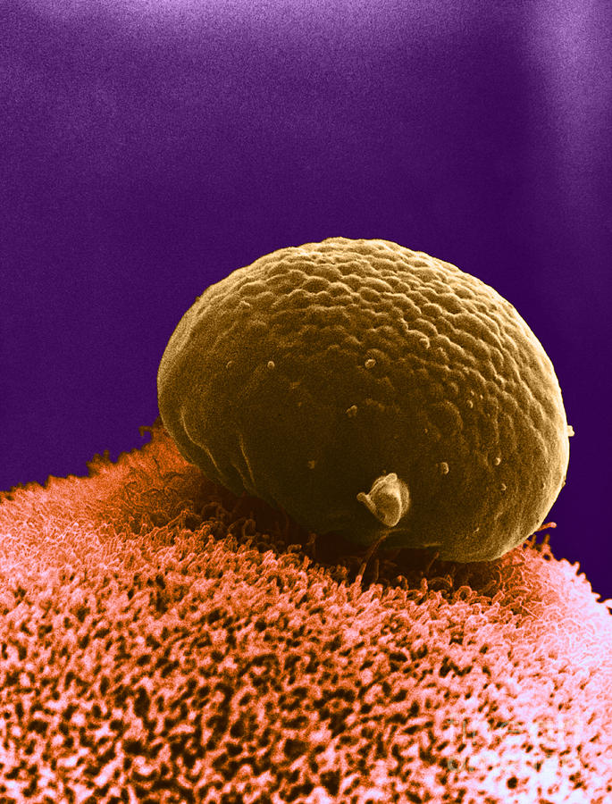 Polar Body On Ovum, Sem Photograph by David M. Phillips - Fine Art America