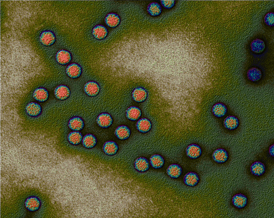 Polio Viruses #4 Photograph by Eye of Science