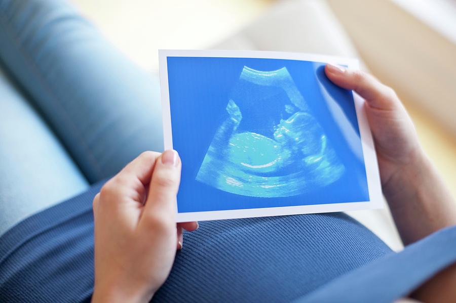 6 Easy Facts About Pregnancy Scan Shown