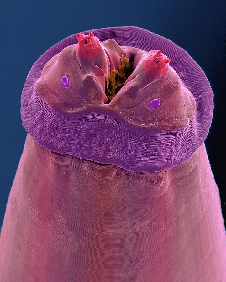 Raccoon Photograph - Raccoon Intestinal Roundworm #4 by Dennis Kunkel Microscopy/science Photo Library