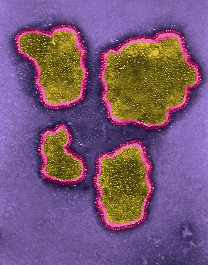 Respiratory Syncytial Virus Photograph by Dennis Kunkel Microscopy ...