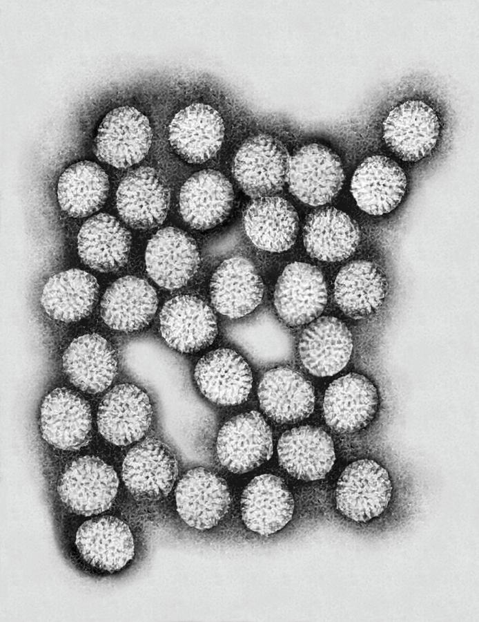 Rotavirus Photograph by Dennis Kunkel Microscopy/science ...