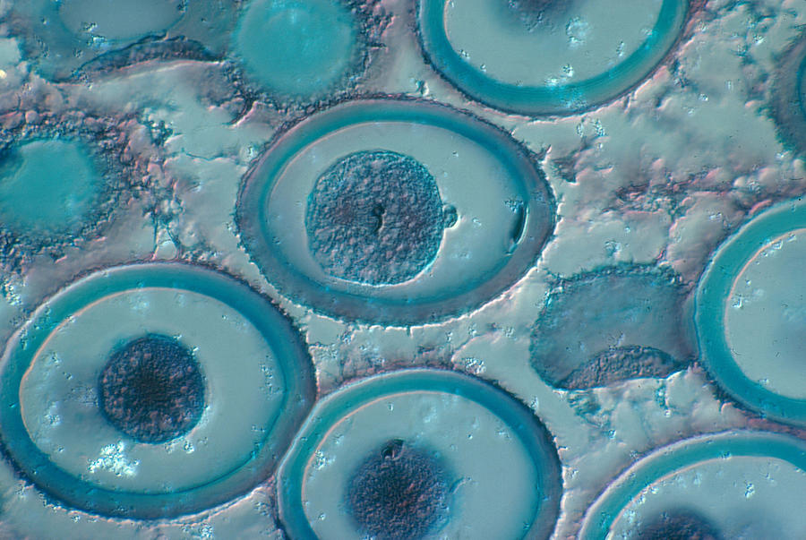 Roundworm Cells In Metaphase, Lm #4 Photograph by Joseph F. Gennaro Jr.