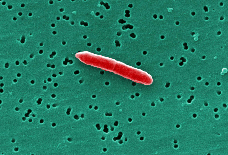 Sebaldella Termitidis Bacteria #4 Photograph by Science Source