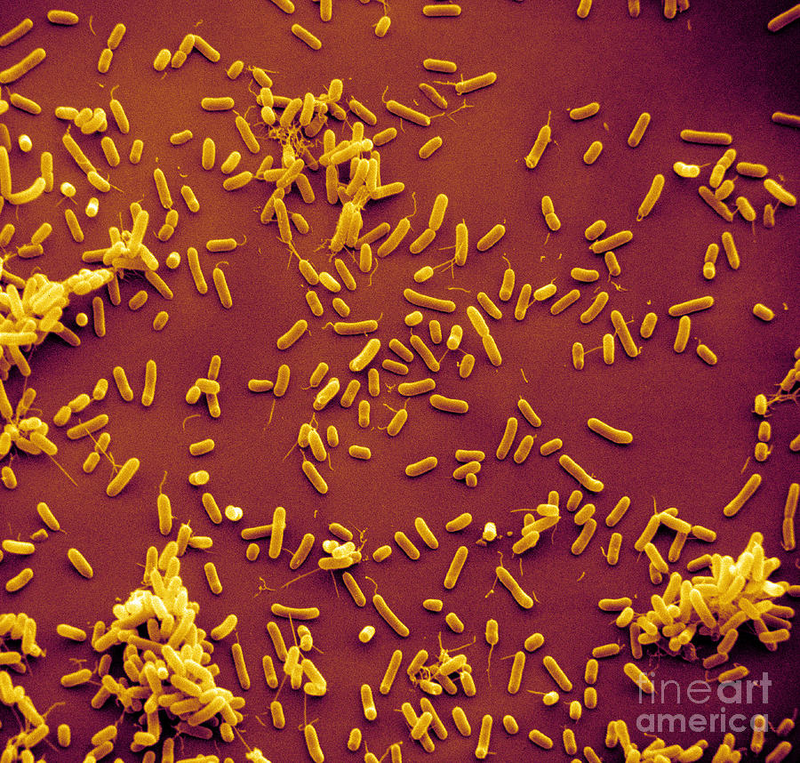 Sem Of Haemophilus Influenzae #4 Photograph by David M. Phillips