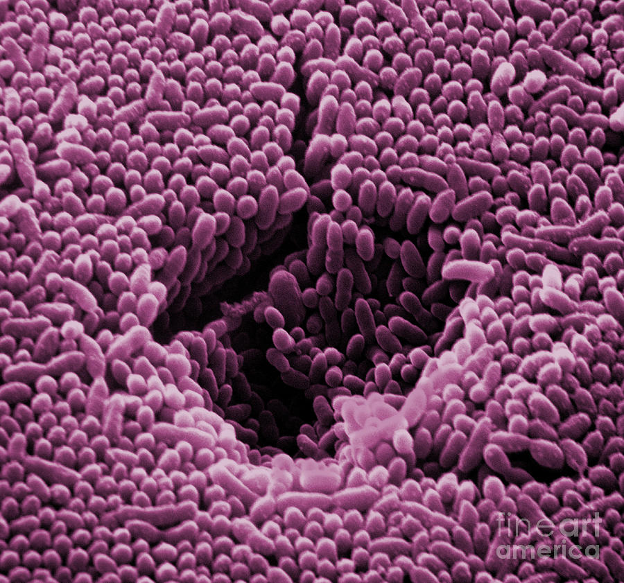 Sem Of Polluted Water #4 Photograph by David M. Phillips