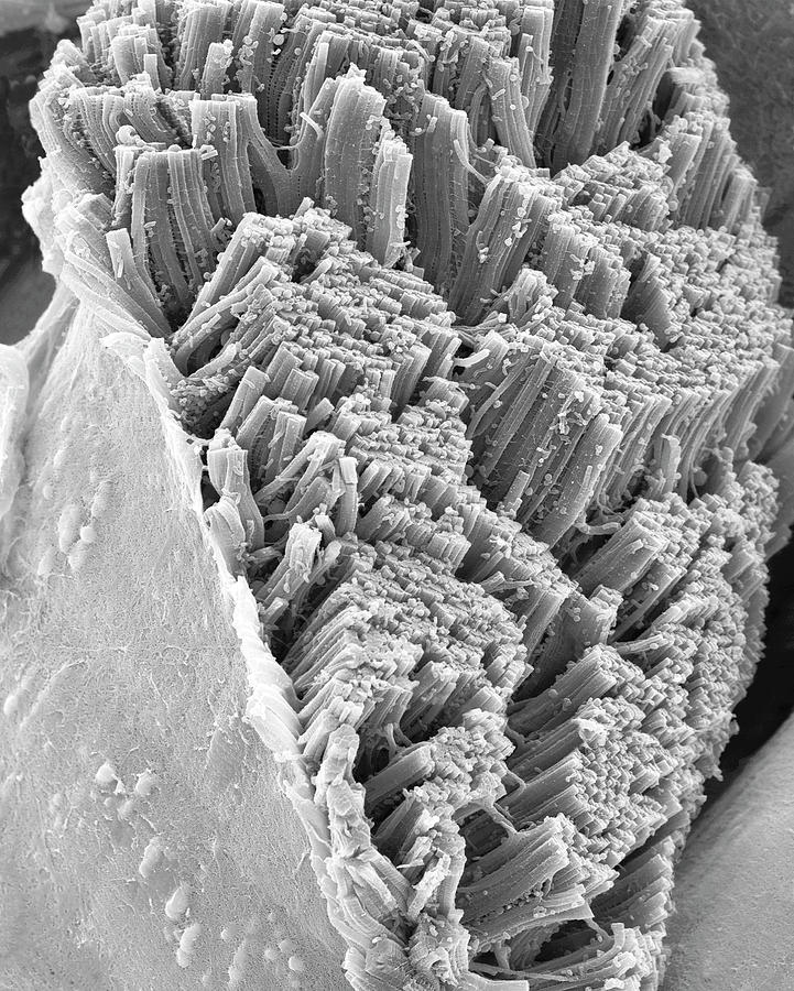 Skeletal Muscle Actin Myosin Filaments #4 Photograph by Dennis Kunkel Microscopy/science Photo Library