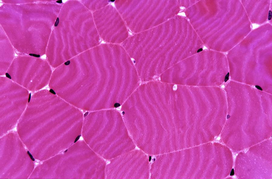 Skeletal Muscle #4 Photograph by Microscape