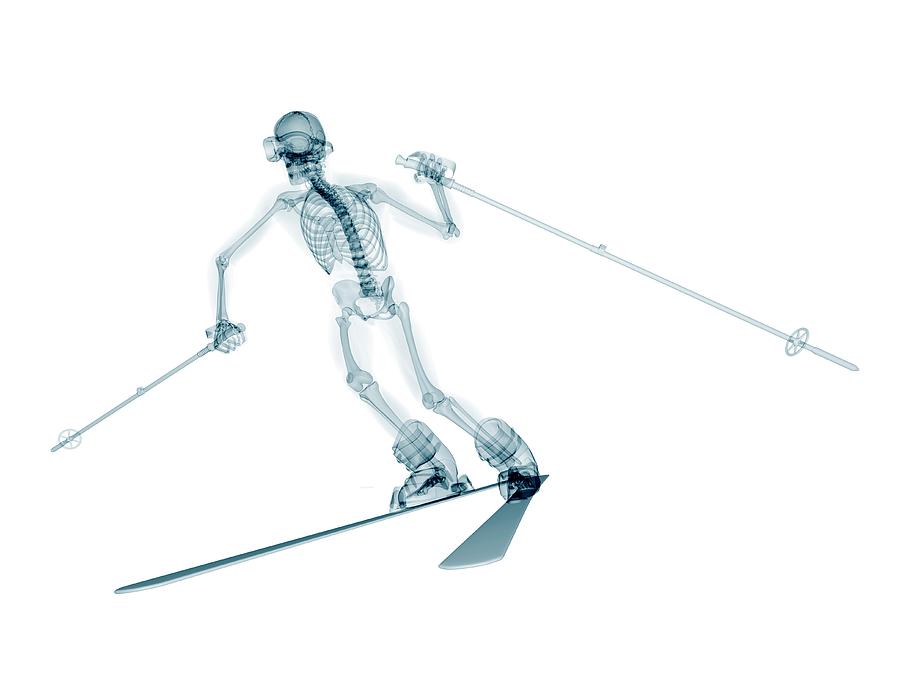 Skeleton Skiing #4 Photograph by Sciepro/science Photo Library