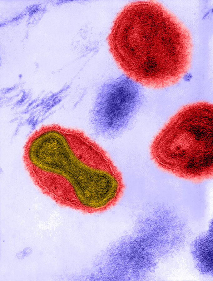Smallpox Virus, Tem #4 Photograph by Science Source