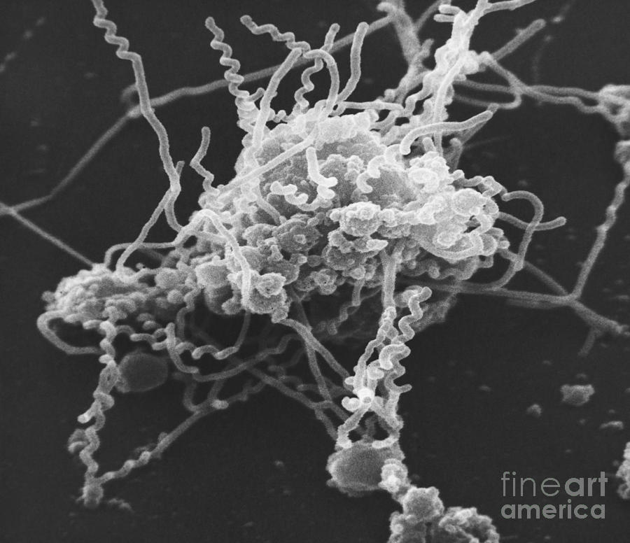 Spiroplasma Bacteria, Sem #4 Photograph by David M. Phillips