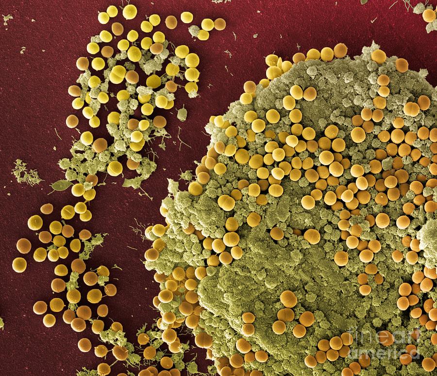 Staphylococcus aureus bacteria - Stock Image - B234/0142 - Science Photo  Library