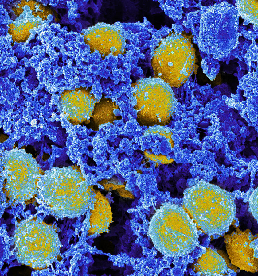 Staphylococcus Aureus Bacteria, Sem #4 Photograph by Science Source