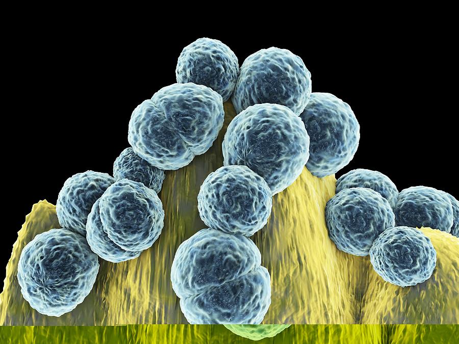 Antibiotic Resistant Photograph - Staphylococcus aureus MRSA bacteria #4 by Science Photo Library