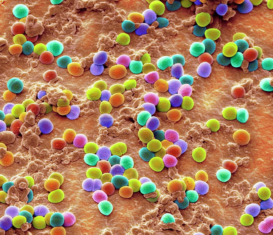 Staphylococcus Bacteria Photograph By Steve Gschmeissner Science Photo