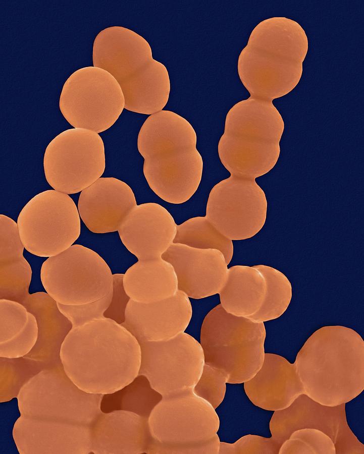 Staphylococcus Epidermidis #4 Photograph by Dennis Kunkel Microscopy/science Photo Library