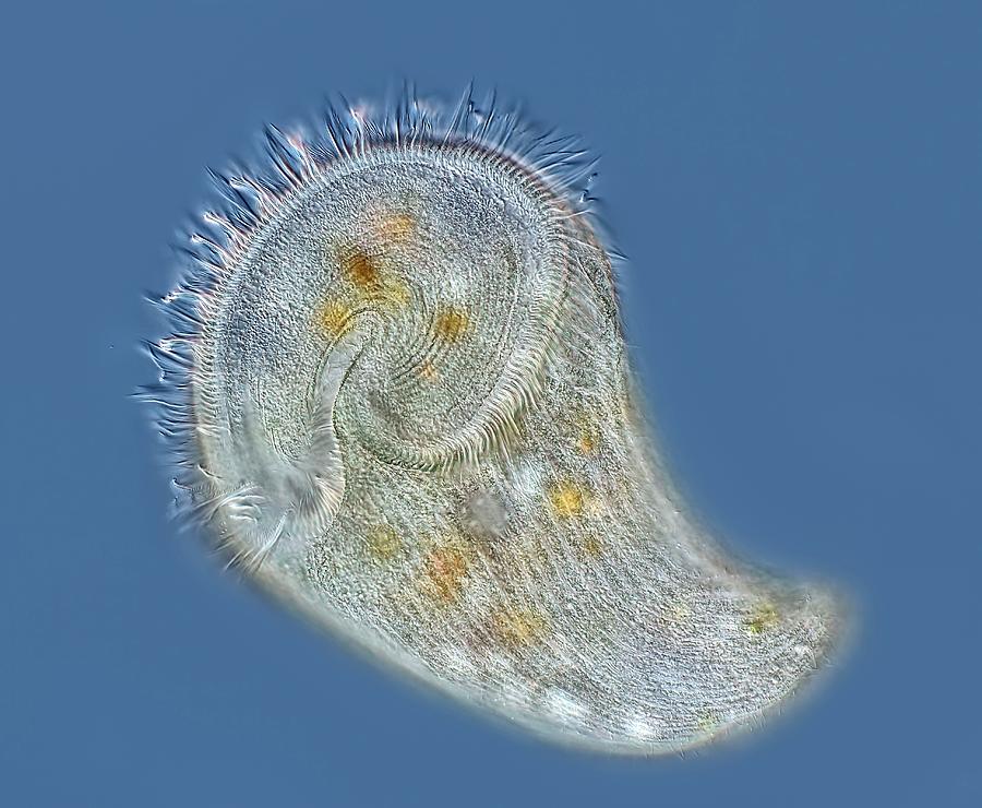 Stentor Protozoan #4 by Science Photo Library