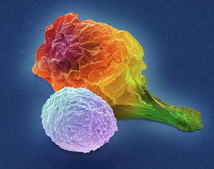 T Lymphocyte And Cancer Cell #4 Photograph by Steve Gschmeissner