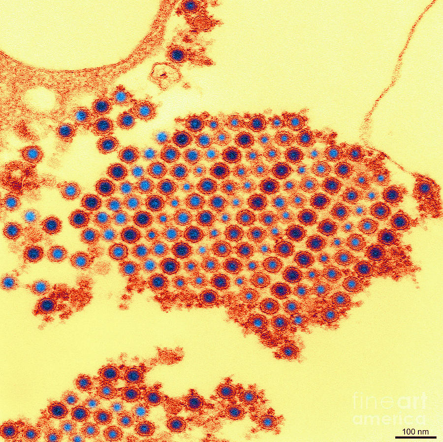 Tem Of Chikungunya Virus #4 Photograph by Science Source