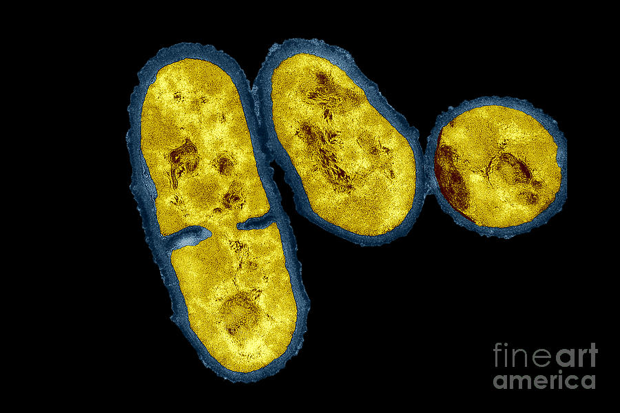 Tem Propionibacterium Acnes #4 Photograph by Kwangshin Kim