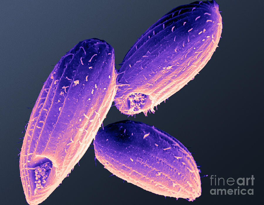 Tetrahymena Ciliate Sem #4 Photograph by David M. Phillips
