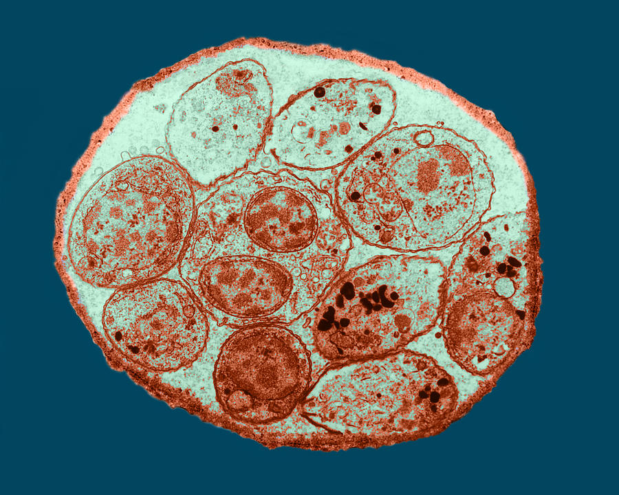 Toxoplasma Cyst Tem #4 Photograph by Science Source