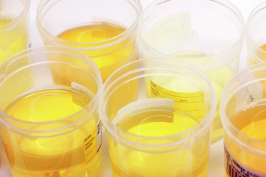 Urine Samples Photograph By Mauro Fermarielloscience Photo Library Pixels 7324