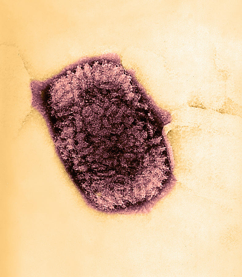Vaccinia Virus, Eradicated Smallpox, Tem #4 Photograph by Science Source