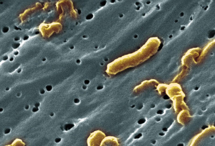 Vibrio Cholerae Bacteria, Sem #4 Photograph by Science Source