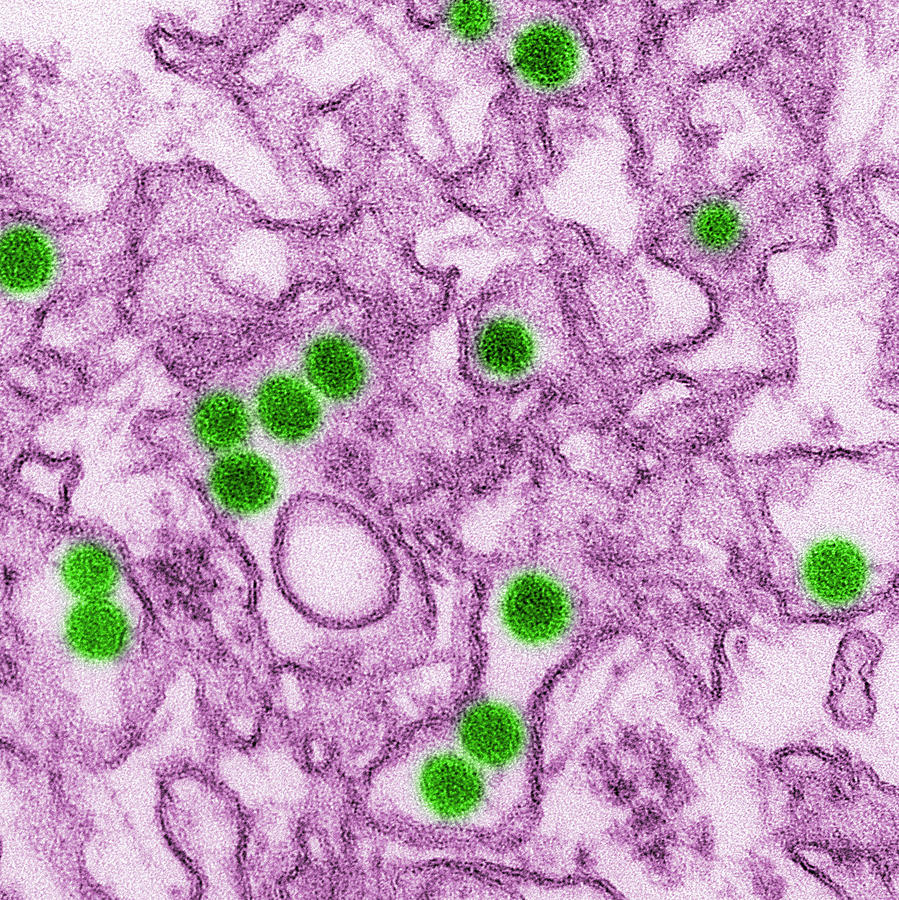Zika Virus, Tem #4 Photograph by Science Source