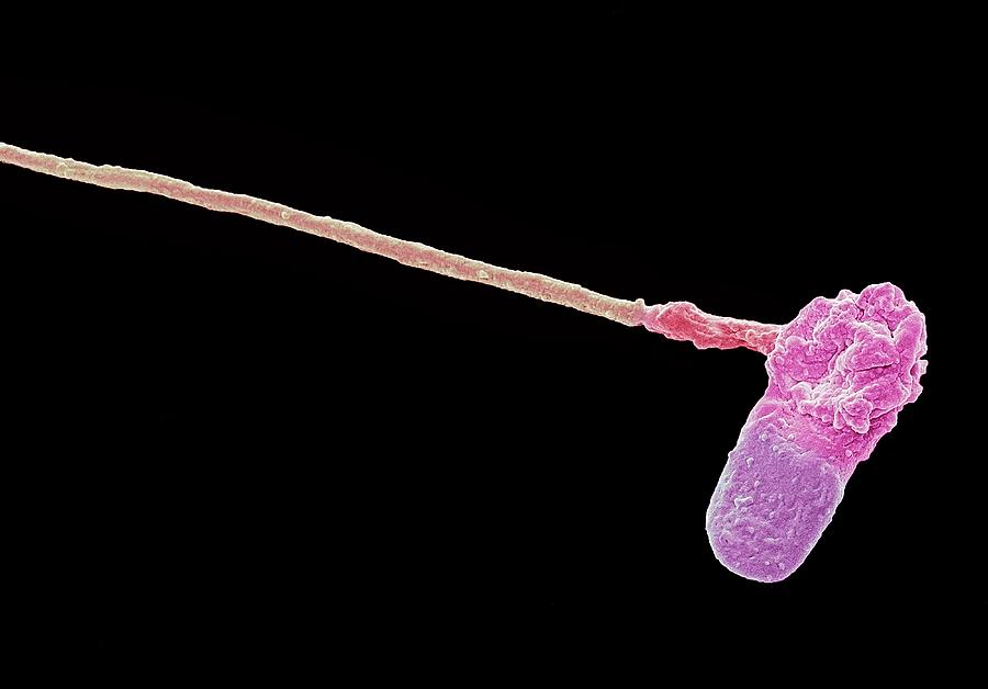 Hockey Stick Photograph - Abnormal Human Sperm Cell #5 by Steve Gschmeissner