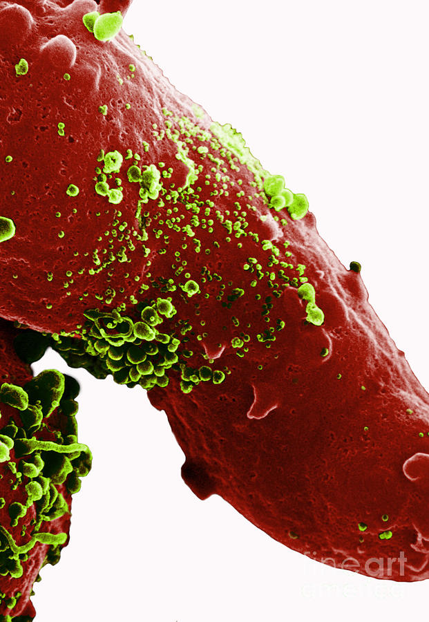 Aids Virus #5 Photograph by Dr. Cecil H. Fox
