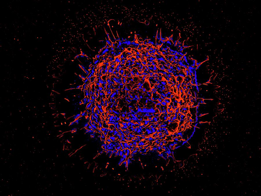 Alveolar Macrophage #5 Photograph by Microscopy Core Facility, Vib Gent
