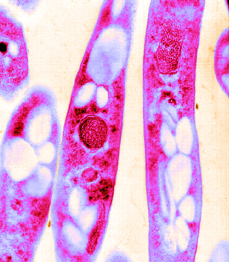 Anthrax, Bacillus Anthracis Bacteria #5 Photograph by Science Source
