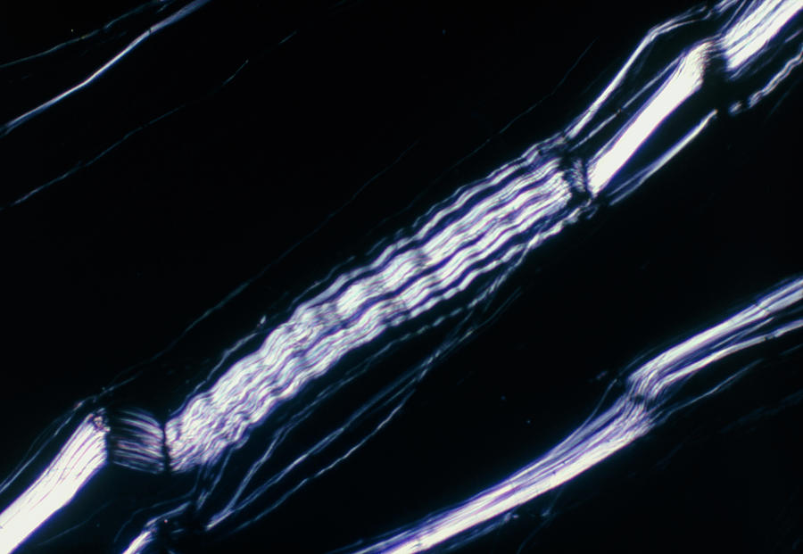 Asbestos Fibres #5 Photograph by Don Thomson/science Photo Library.