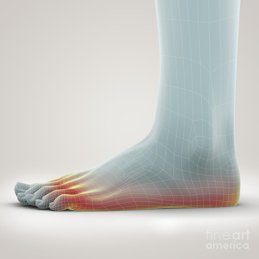 Athletes Foot #5 Photograph by Science Picture Co