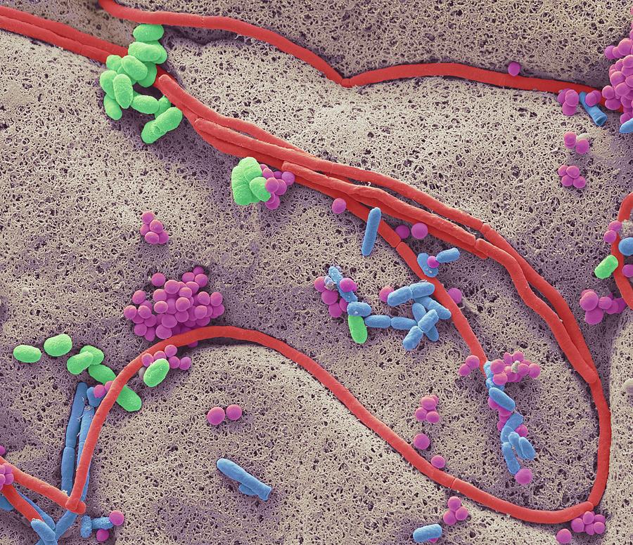 Bacteria Found On Mobile Phone Photograph By Steve Gschmeissner Science