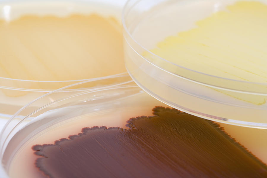 Bacterial Culture Plates #5 Photograph by Science Stock Photography