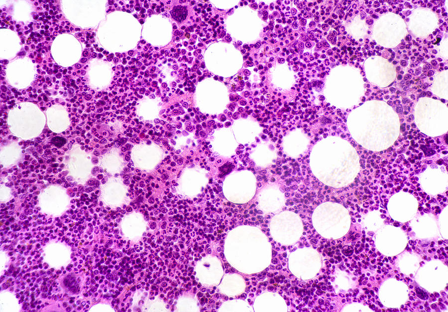 Bone Marrow Section, Lm #5 Photograph by Science Stock Photography