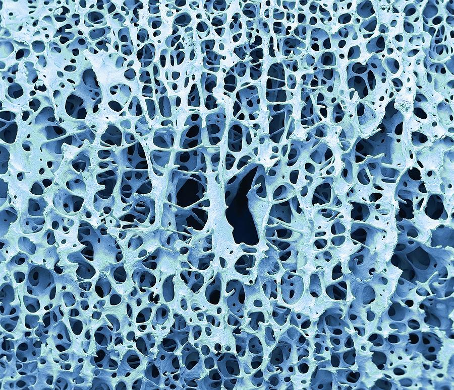 Bone Tissue Photograph by Steve Gschmeissner
