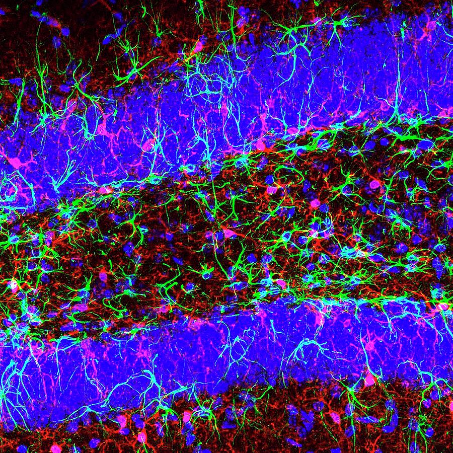 Brain Cells #5 Photograph by Dr. Chris Henstridge