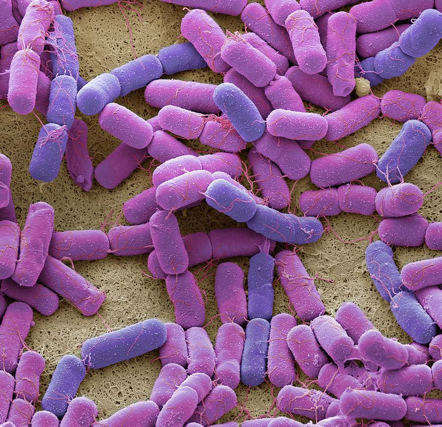 Breast Milk Bacteria #5 Photograph by Steve Gschmeissner/science Photo Library