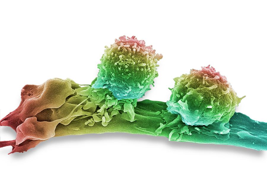 Cancer Cell And T Lymphocytes #5 Photograph by Steve Gschmeissner