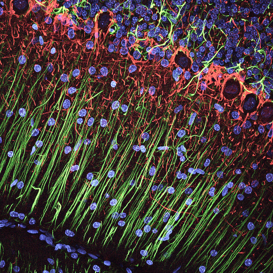Cerebellum Tissue #5 Photograph by C.j.guerin, Phd, Mrc Toxicology Unit/ Science Photo Library