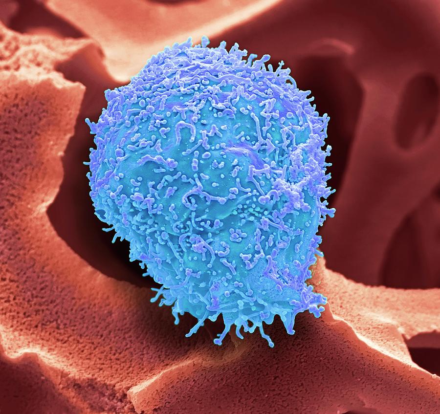 Cervical Cancer Cell Photograph by Steve Gschmeissner - Fine Art America