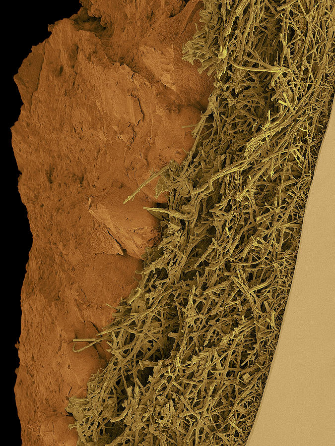 Chicken Eggshell Cross Section #5 Photograph by Dennis Kunkel Microscopy/science Photo Library