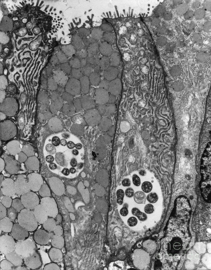 Chlamydia Infection, Tem #5 Photograph by David M. Phillips