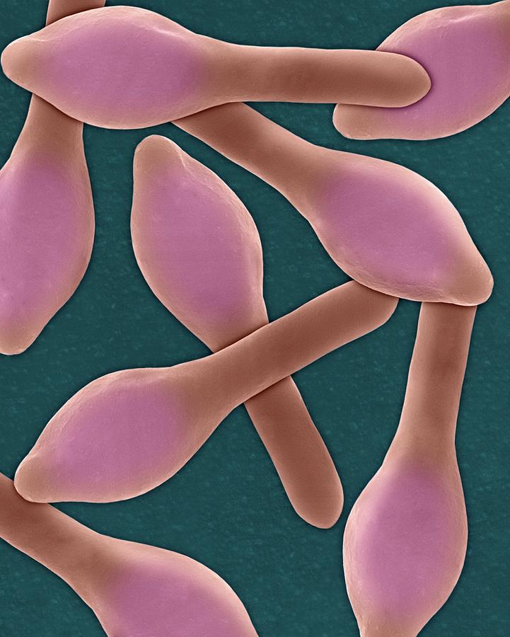 Clostridium Botulinum Photograph By Dennis Kunkel Microscopyscience Photo Library 