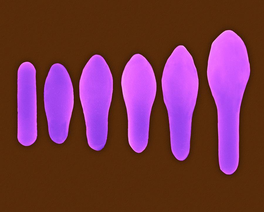 Bacillus Photograph - Clostridium Spore Development #5 by Dennis Kunkel Microscopy/science Photo Library