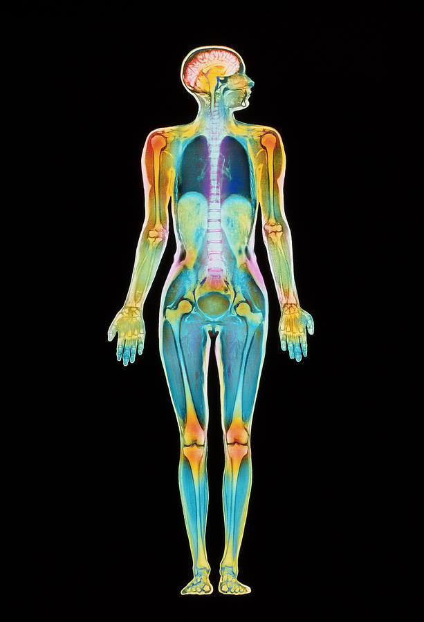 Coloured Mri Scan Of A Whole Human Body (female) Photograph by Simon ...